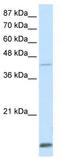 Homeobox protein Mohawk antibody, TA330613, Origene, Western Blot image 