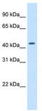 Small Nuclear RNA Activating Complex Polypeptide 1 antibody, TA335789, Origene, Western Blot image 