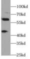 ADP Ribosylation Factor Like GTPase 13B antibody, FNab00572, FineTest, Western Blot image 