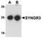 Synaptogyrin 3 antibody, orb75342, Biorbyt, Western Blot image 