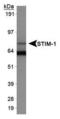 Stromal Interaction Molecule 1 antibody, PA1-46217, Invitrogen Antibodies, Western Blot image 