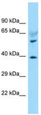 Lysophosphatidic Acid Receptor 6 antibody, TA331336, Origene, Western Blot image 