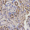 Epoxide hydratase antibody, LS-C331746, Lifespan Biosciences, Immunohistochemistry paraffin image 