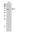 Bone Morphogenetic Protein 6 antibody, STJ97350, St John