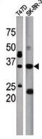 Isoprenylcysteine Carboxyl Methyltransferase antibody, abx031628, Abbexa, Western Blot image 