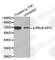 RELB Proto-Oncogene, NF-KB Subunit antibody, AP0240, ABclonal Technology, Western Blot image 