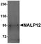 NLR Family Pyrin Domain Containing 12 antibody, orb75492, Biorbyt, Western Blot image 