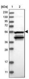 Carboxyl-terminal PDZ ligand of neuronal nitric oxide synthase protein antibody, NBP2-38151, Novus Biologicals, Western Blot image 