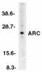 ARC/ARG3.1 antibody, PA1-30682, Invitrogen Antibodies, Western Blot image 