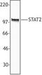 Signal Transducer And Activator Of Transcription 2 antibody, TA328010, Origene, Western Blot image 