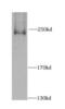 CAD protein antibody, FNab01183, FineTest, Western Blot image 