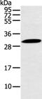 YrdC N6-Threonylcarbamoyltransferase Domain Containing antibody, PA5-51282, Invitrogen Antibodies, Western Blot image 