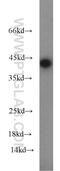 ORM1 antibody, 16439-1-AP, Proteintech Group, Western Blot image 