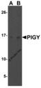 Phosphatidylinositol Glycan Anchor Biosynthesis Class Y antibody, 4955, ProSci, Western Blot image 