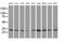 Capping Actin Protein Of Muscle Z-Line Subunit Alpha 1 antibody, MA5-25094, Invitrogen Antibodies, Western Blot image 