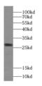 VAMP Associated Protein B And C antibody, FNab09371, FineTest, Western Blot image 