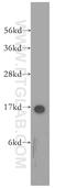 SH2 Domain Containing 1A antibody, 11868-1-AP, Proteintech Group, Western Blot image 