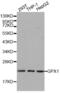 Glutathione Peroxidase 1 antibody, abx001027, Abbexa, Western Blot image 