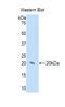 Interleukin 17 Receptor D antibody, LS-C294857, Lifespan Biosciences, Western Blot image 