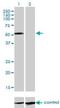Interleukin 13 Receptor Subunit Alpha 2 antibody, H00003598-M01, Novus Biologicals, Western Blot image 