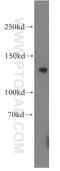 Transient Receptor Potential Cation Channel Subfamily C Member 1 antibody, 19482-1-AP, Proteintech Group, Western Blot image 