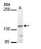 Ubiquitin conjugation factor E4 B antibody, GTX109385, GeneTex, Western Blot image 