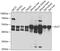Dihydrolipoyllysine-residue succinyltransferase component of 2-oxoglutarate dehydrogenase complex, mitochondrial antibody, GTX33156, GeneTex, Western Blot image 