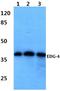 Lysophosphatidic Acid Receptor 2 antibody, GTX66695, GeneTex, Western Blot image 