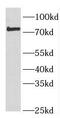 Forkhead Box P2 antibody, FNab03207, FineTest, Western Blot image 