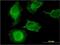  antibody, H00092979-M01, Novus Biologicals, Immunocytochemistry image 