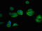 Phosphoglycerate Dehydrogenase antibody, A51657-100, Epigentek, Immunofluorescence image 