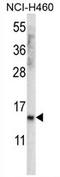 Putative uncharacterized protein UNQ3029/PRO9830 antibody, AP54467PU-N, Origene, Western Blot image 