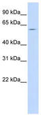 Solute carrier family 15 member 4 antibody, TA334601, Origene, Western Blot image 