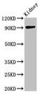 ADAM Metallopeptidase With Thrombospondin Type 1 Motif 4 antibody, CSB-PA001311LA01HU, Cusabio, Western Blot image 