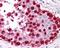 Melanoma-associated antigen 1 antibody, 48-549, ProSci, Immunohistochemistry frozen image 