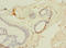 ADP/ATP translocase 1 antibody, A60962-100, Epigentek, Immunohistochemistry paraffin image 