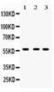 Cytochrome P450 Family 27 Subfamily B Member 1 antibody, PB9548, Boster Biological Technology, Western Blot image 