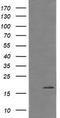 Cancer/Testis Antigen 1B antibody, TA505970BM, Origene, Western Blot image 
