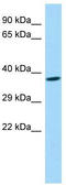 Abhydrolase Domain Containing 17A antibody, TA331704, Origene, Western Blot image 