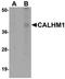 Calcium Homeostasis Modulator 1 antibody, orb75355, Biorbyt, Western Blot image 