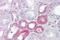 Klotho antibody, ARP41551_P050, Aviva Systems Biology, Immunohistochemistry paraffin image 