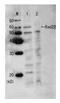 DNA repair and recombination protein rad22 antibody, GTX64148, GeneTex, Western Blot image 