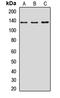 NODAL Modulator 1 antibody, LS-C668177, Lifespan Biosciences, Western Blot image 