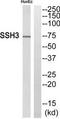 Protein phosphatase Slingshot homolog 3 antibody, TA315555, Origene, Western Blot image 