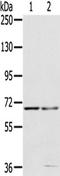 Matrix metalloproteinase-24 antibody, TA350713, Origene, Western Blot image 