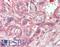 CAD protein antibody, LS-B11936, Lifespan Biosciences, Immunohistochemistry paraffin image 
