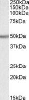 UDP-glucuronosyltransferase 2B2 antibody, MBS422559, MyBioSource, Western Blot image 