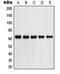 Coagulation Factor X antibody, orb213915, Biorbyt, Western Blot image 