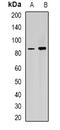 Retinitis Pigmentosa GTPase Regulator antibody, orb340785, Biorbyt, Western Blot image 