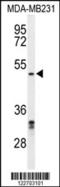 Chromobox protein homolog 2 antibody, 64-022, ProSci, Western Blot image 